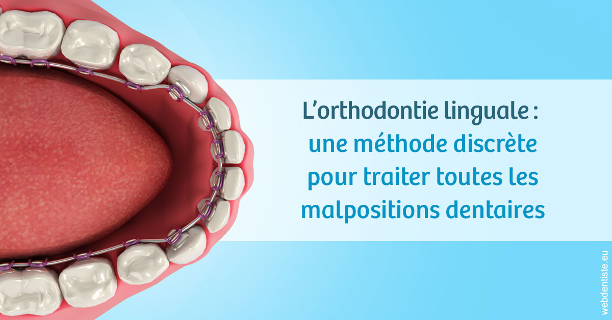 https://selarl-dr-philippe-schweizer.chirurgiens-dentistes.fr/L'orthodontie linguale 1