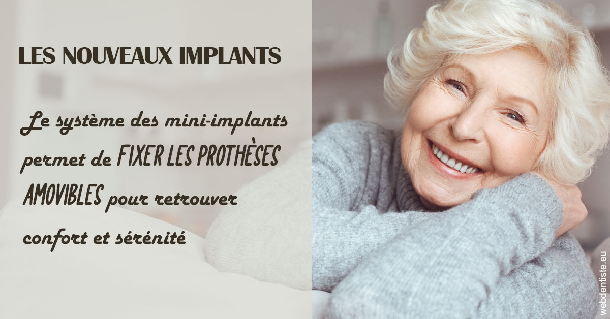 https://selarl-dr-philippe-schweizer.chirurgiens-dentistes.fr/Les nouveaux implants 1