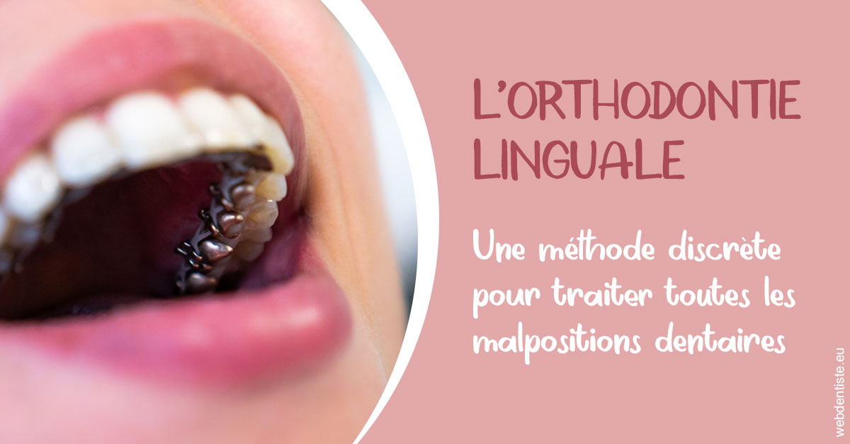 https://selarl-dr-philippe-schweizer.chirurgiens-dentistes.fr/L'orthodontie linguale 2