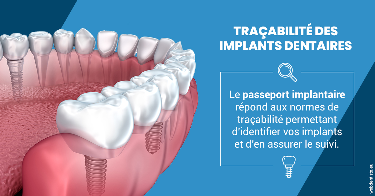 https://selarl-dr-philippe-schweizer.chirurgiens-dentistes.fr/T2 2023 - Traçabilité des implants 1