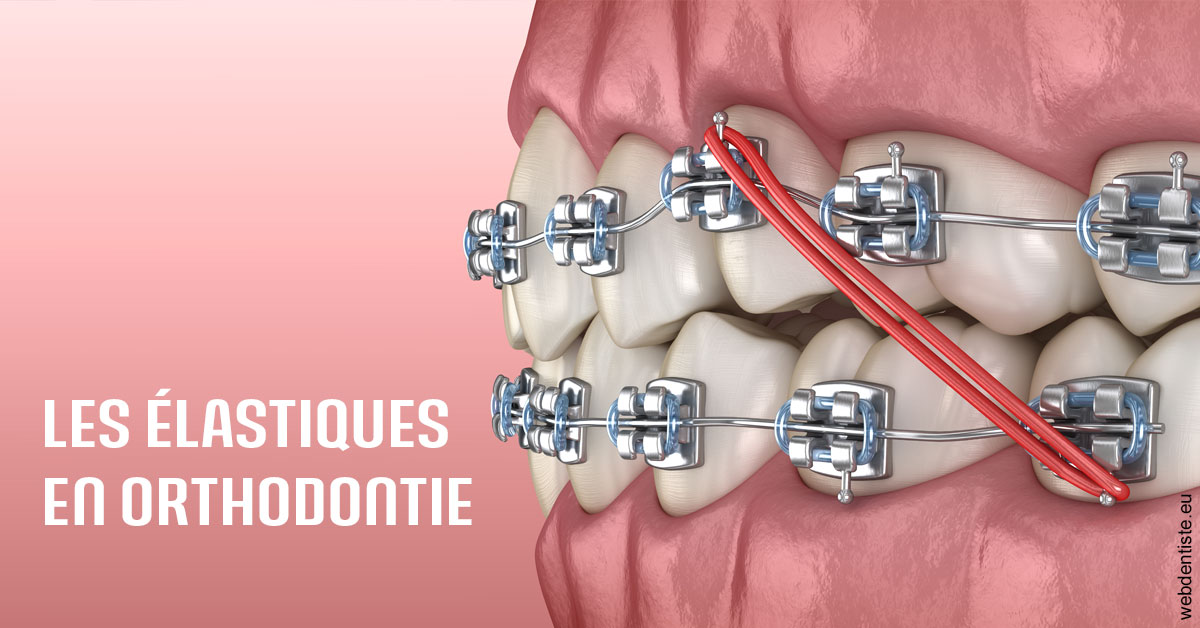 https://selarl-dr-philippe-schweizer.chirurgiens-dentistes.fr/Elastiques orthodontie 2